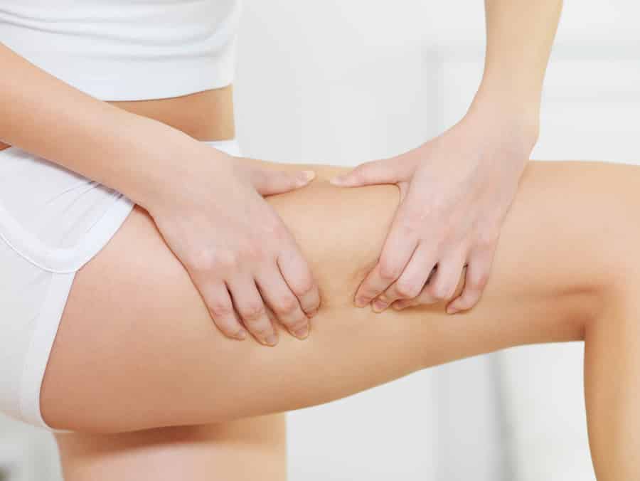 Avete la cellulite? Ecco perchè